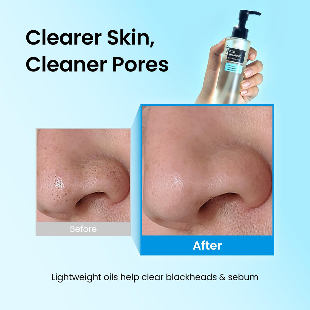 coxir Ultra Hyaluronic Cleansing Oil, Hydrating Makeup Remover, 5.07 fl.oz