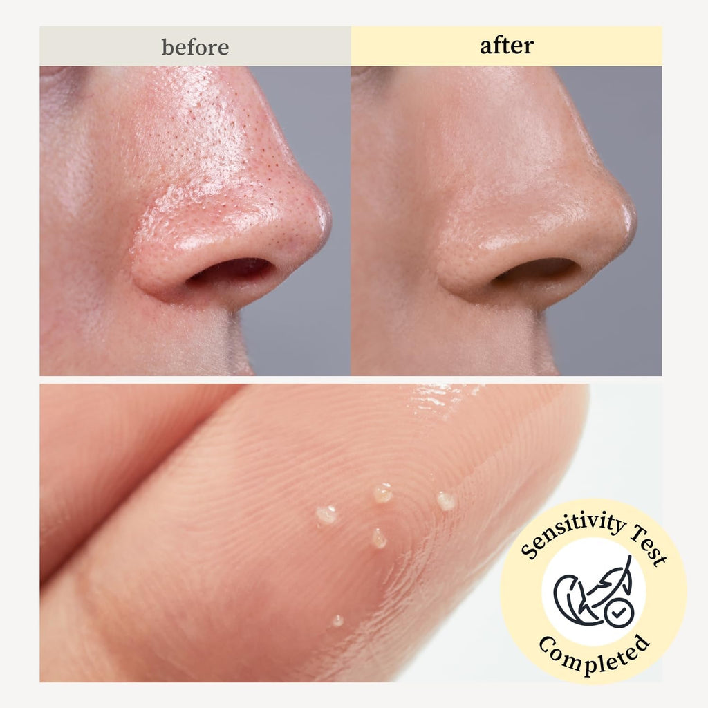 NOONI Snow Aqua 0 LHA Toning Cleansing Oil - Makeup Blackhead Remover