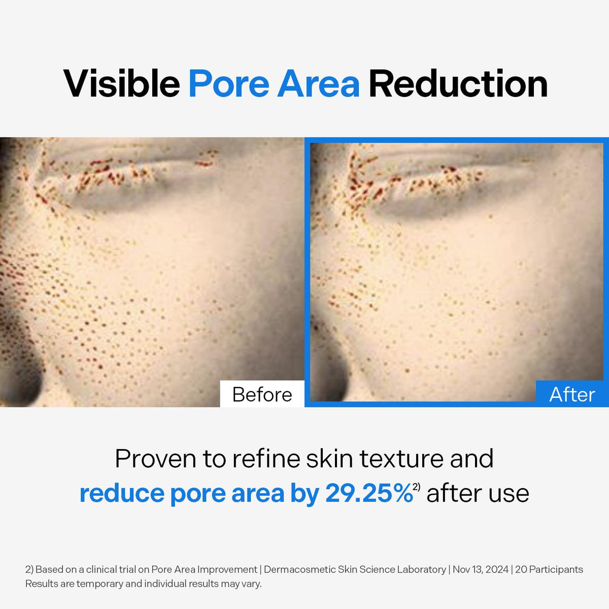Torriden DIVE IN Cleansing Oil 200ml (6.76 fl.oz.) | Makeup Blackhead Remover | Hydrating Deep Facial Cleanser for All and Sensitive Skin | Hyaluronic Acid, Panthenol, Allantoin | Korean Skin Care