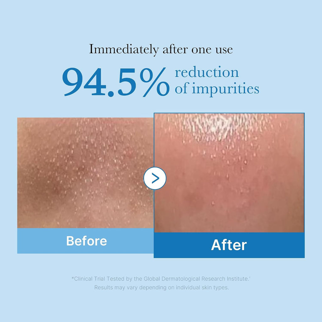 medicube Cleansing Oil Zero Pore Blackhead