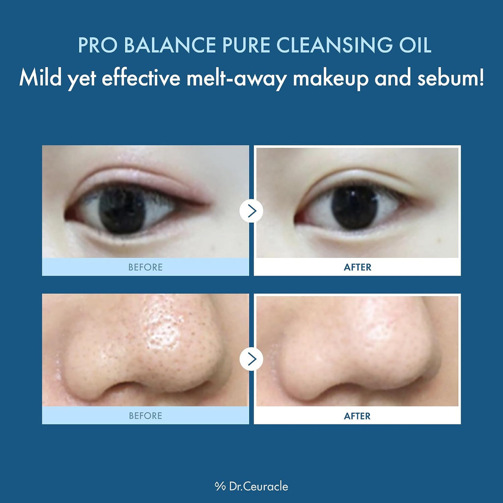 Dr.Ceuracle Pro Balance Pure Cleansing Oil, Pore Sebum Cleanser 5.24 fl oz.