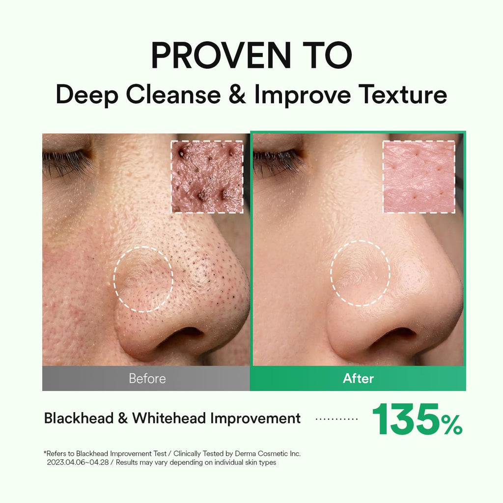 VEGANIFECT LHA Cleansing Oil, Pore Control, Blackhead Remover & Sebum Care, Gentle Melting Oil Cleanser for Face, Makeup Remover, Korean Skincare 205ml/6.93 fl oz